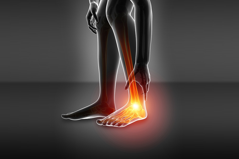 Diagnosis and Treatment of Ankle Arthritis