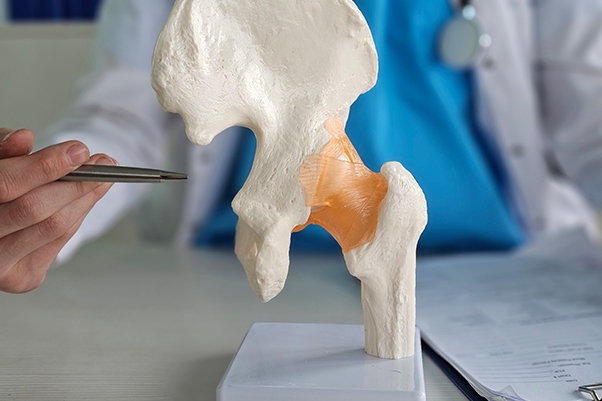 Direct Anterior vs. Posterior Hip Replacement: What's the Difference?