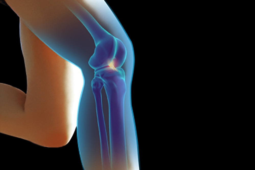 Find the Answers to Common ACL Surgery Questions (Video)