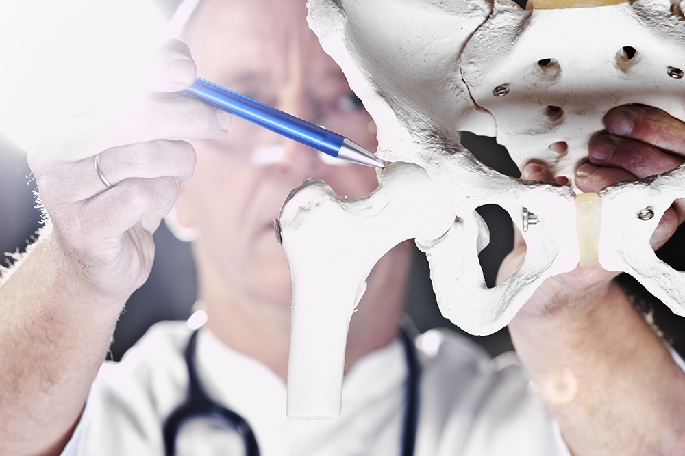 Hip Dysplasia in Adults: Symptoms, Treatments, and Long-Term Care