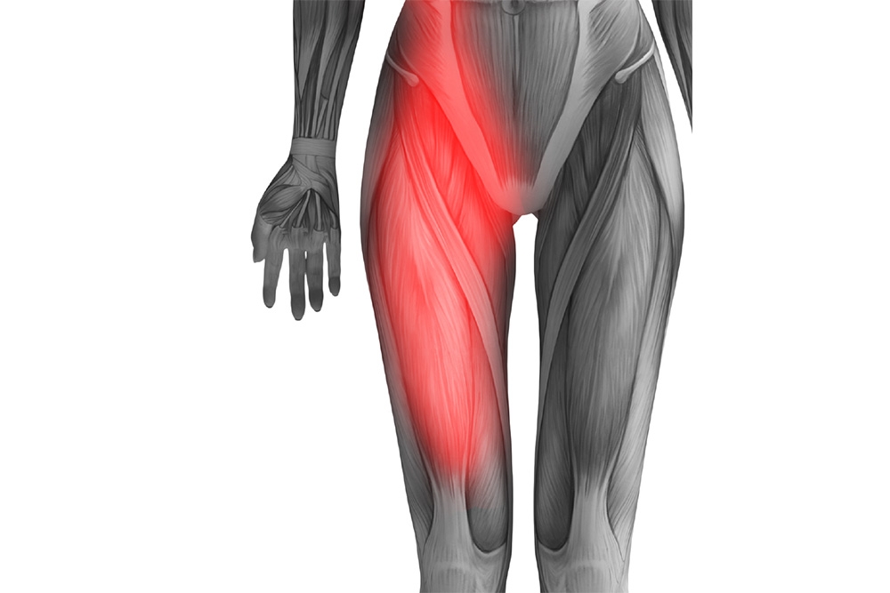 Hip Flexor Pain: Identifying Locations, Symptoms, and Causes