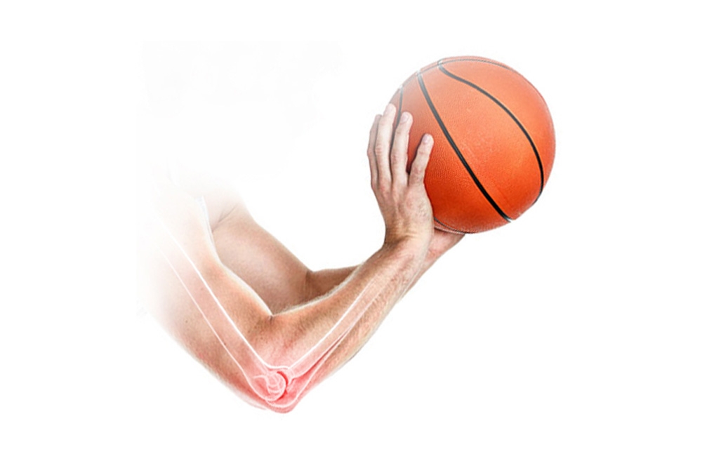 How to Prevent an Overuse Injury in Athletes