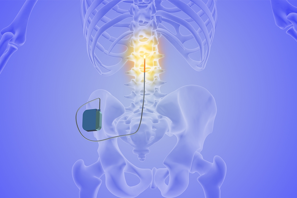 Interventional Pain Management for Spine Conditions: What Are Your Options?