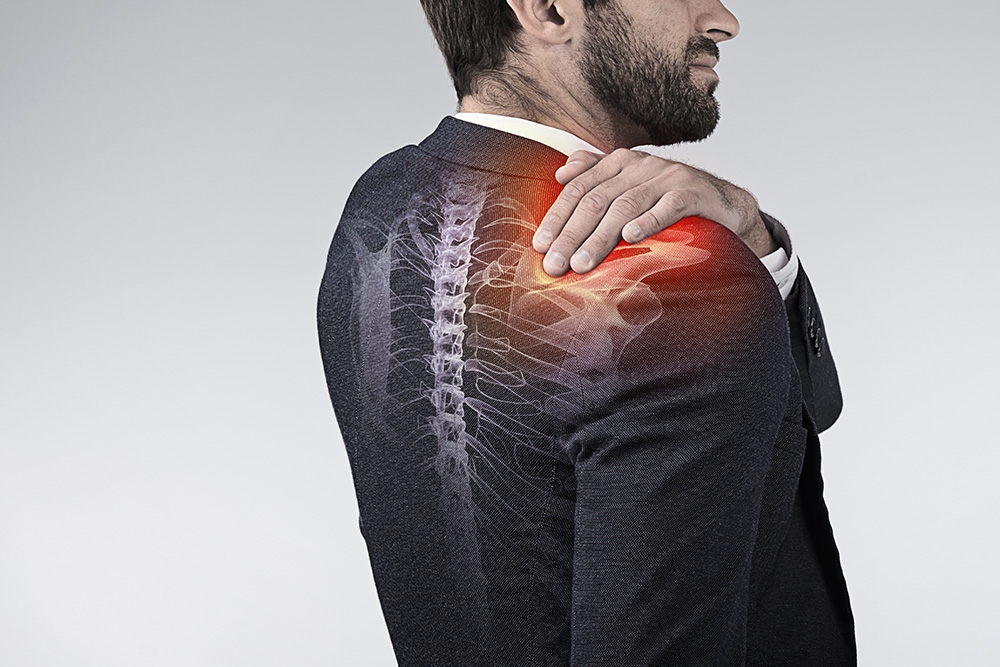 Sleeping Comfortably With a Pinched Nerve in Your Shoulder Blade: Tips and Relief Strategies