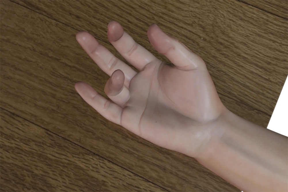 Treating Trigger Finger: Comprehensive Solutions at Town Center Orthopaedics