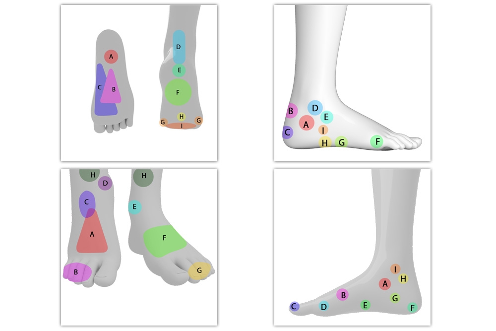Why Does Your Foot Hurt? Check Out This Foot Pain Chart