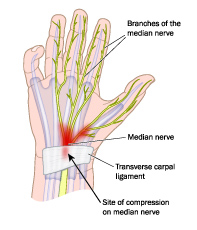 Illustration of anatomy of the hand and wrist, site of carpal tunnel syndrome