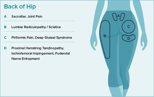 A hip pain location diagram shows where pain in the back of the hip could occur. 