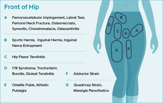 A hip pain location diagram shows where pain in the front of the hip could occur. 